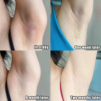 Whitening Cream for Underarms, Knees & Inner Thighs – Brightening Moisturizing Body Serum for Even Skin Tone Care