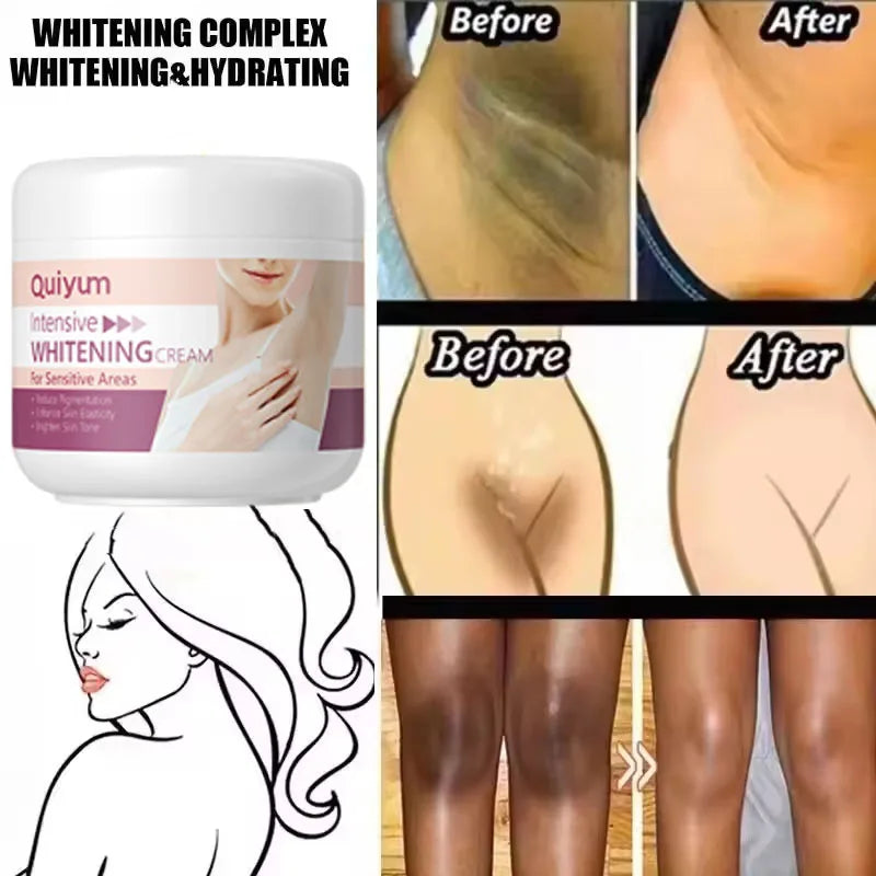Whitening Body Cream for Underarm & Intimate Areas – Skin Brightening Moisturizer for Dark Skin Tone Care Korean Beauty Skincare Product