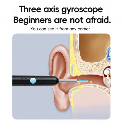 Smart Visual Ear Cleaner Set with 1080P Camera – WiFi Ear Wax Removal Tool with HD LED Lights & Earpick Endoscope