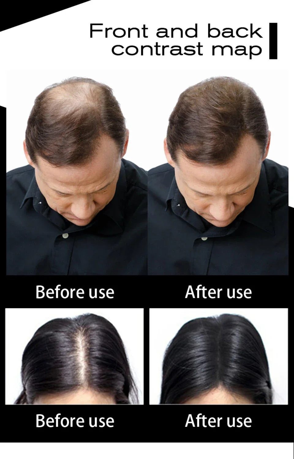 SEVICH Keratin Hair Fiber 100g – Hair Thickening & Building Powder Spray, Instant Regrowth & Hair Loss Concealer