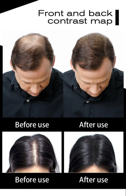 SEVICH Keratin Hair Fiber 100g – Hair Thickening & Building Powder Spray, Instant Regrowth & Hair Loss Concealer