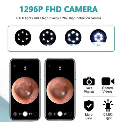 Wireless Smart Visual Ear Cleaner – 1296P Camera Otoscope Ear Wax Removal Health Care Kit