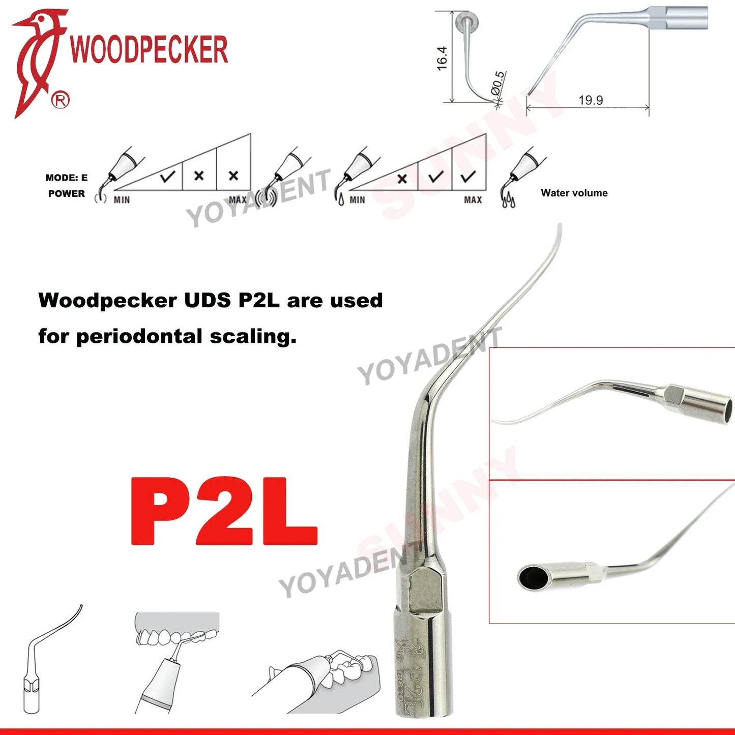 Woodpecker Dental Scaler Tips – Ultrasonic Tooth Cleaning, Endo & Perio Scaling Tips, Fit EMS UDS Scaler Handpiece