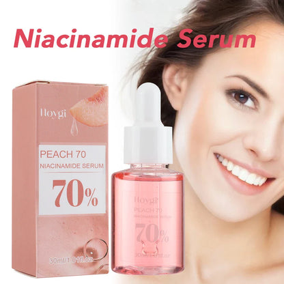 30ml Niacinamide Serum – Dark Spot Corrector, Melanin Removal & Pore-Shrinking Hydrating Skin Care