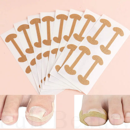 Ingrown Nail Correction Stickers - 40/100/200pcs Toenail Corrector Patches for Paronychia Treatment and Pedicure Recovery