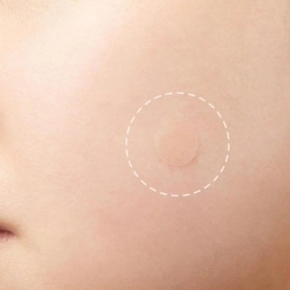 72pcs Invisible Anti-Acne Pimple Patches – Hydrocolloid Waterproof Spot & Mark Repair Stickers