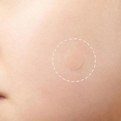 72pcs Invisible Anti-Acne Pimple Patches – Hydrocolloid Waterproof Spot & Mark Repair Stickers