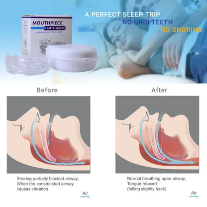 Anti-Snoring Mouth Guard: Stop Snoring, Improve Sleep, and Prevent Teeth Grinding - Effective Bruxism and Apnea Solution