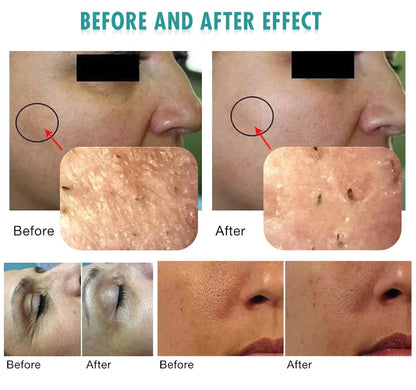 2025 Latest 3 in 1 CO2 Nano-Bubbles Technology Oxy Facial Machine, Face Lifting, Skin Rejuvenation, and Tightening for Spa and Salon Use