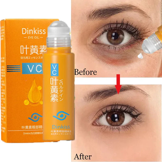 Anti-Dark Circle Eye Serum — Retinol Oil for Wrinkle Removal, Firming, Eye Bag Reduction, Fine Line Fading & Brightening Korean Eye Care