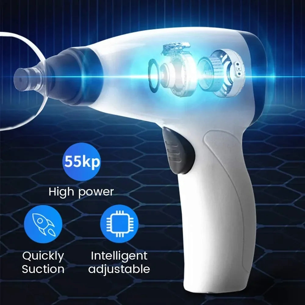 Electric Cupping Machine – Household Vacuum Cupping Set with Easy Suction Gas Tank
