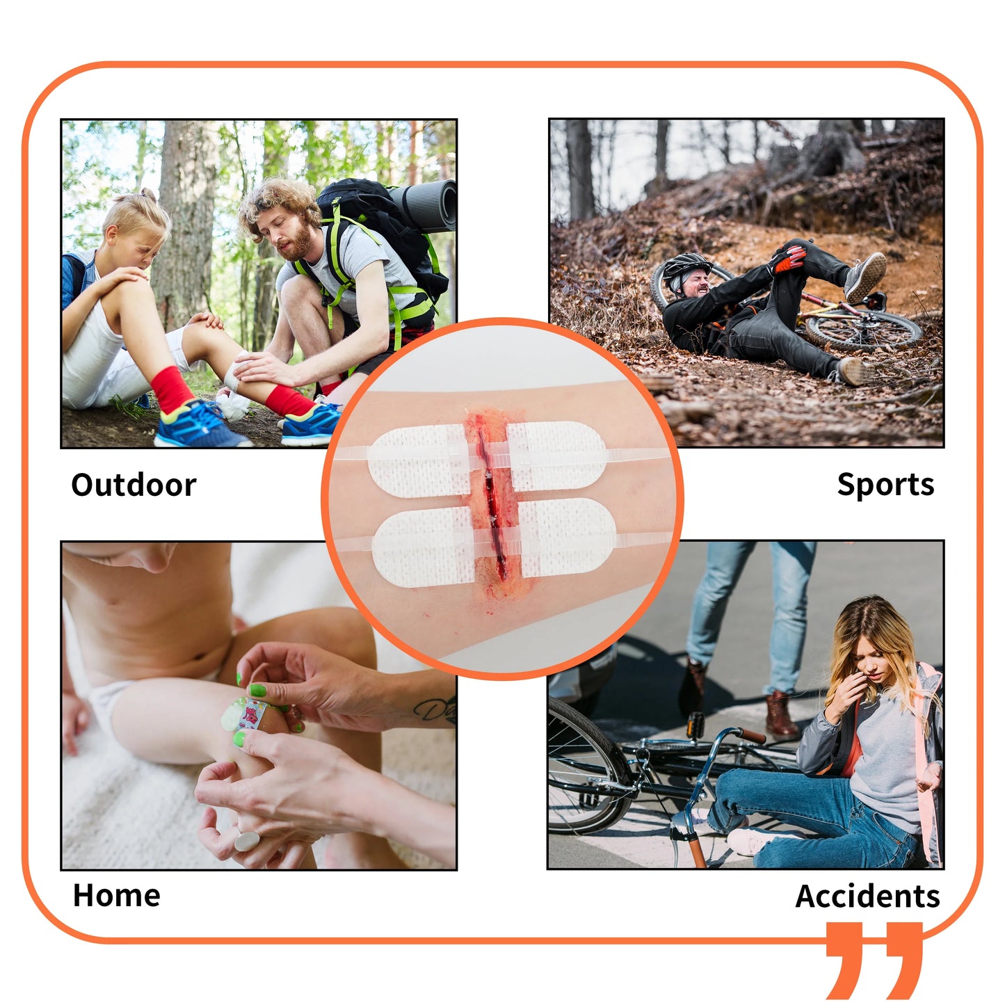 RHINO RESCUE Zip Stitch — Wound Closure Strips, Adhesive Bandages for Cut Care Without Sutures