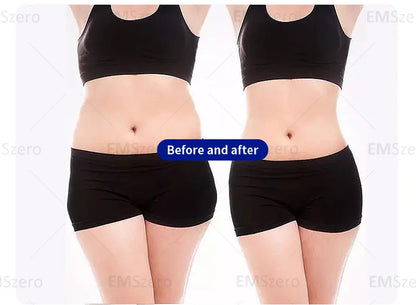 EMSzero Mini Body Sculpting Machine | NEO RF Electromagnetic Muscle Stimulation & Fat Removal 2025