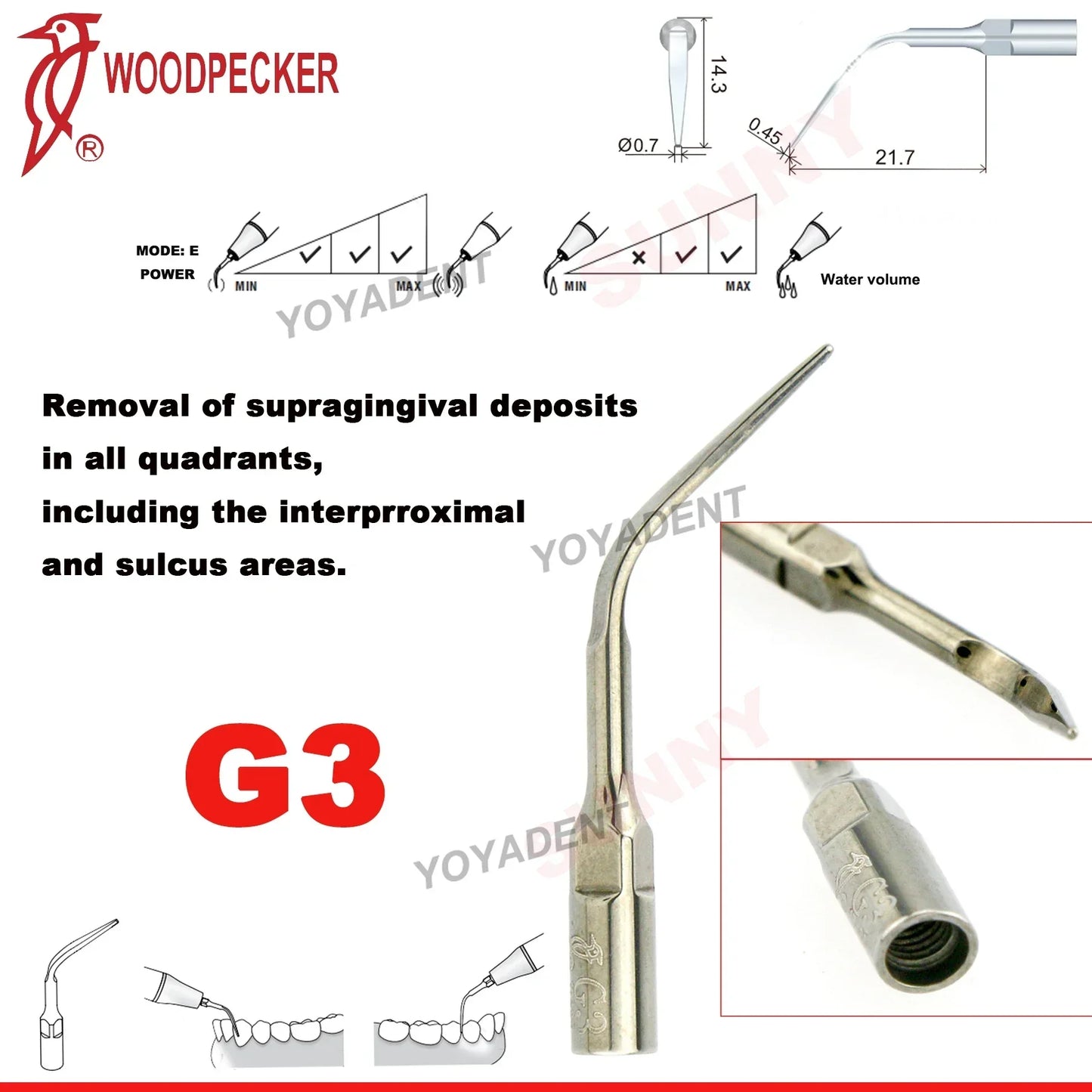 Woodpecker Dental Scaler Tips – Ultrasonic Tooth Cleaning, Endo & Perio Scaling Tips, Fit EMS UDS Scaler Handpiece