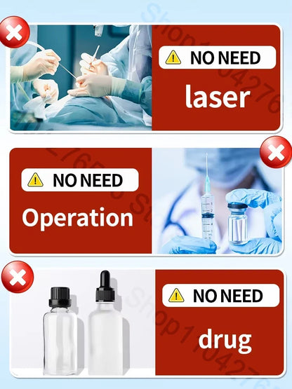 Tattoo Removal Spray — Fast-Acting Formula Removes Tattoos in 7 Days