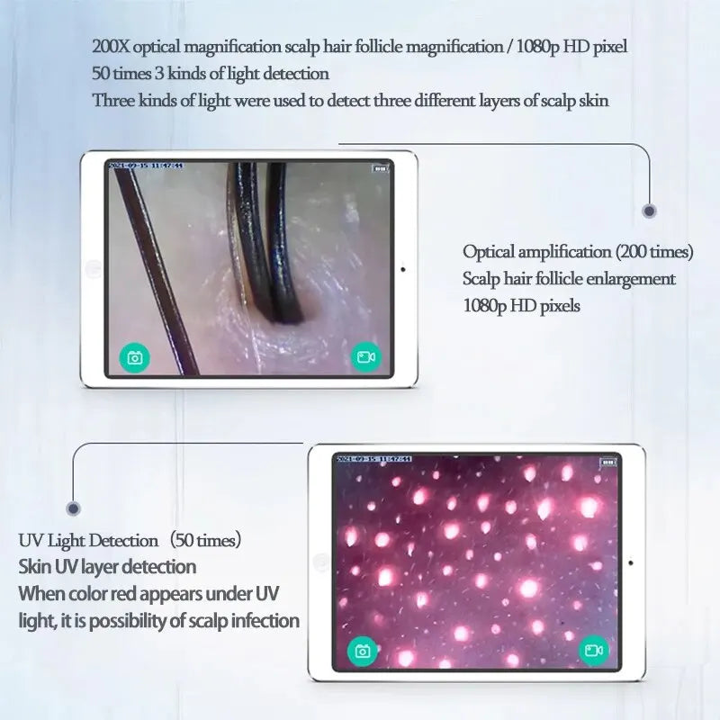 WiFi HD 5G Scalp, Skin & Hair Follicle Detector – 50X/200X Rechargeable UV Skin Analyzer Magnifier