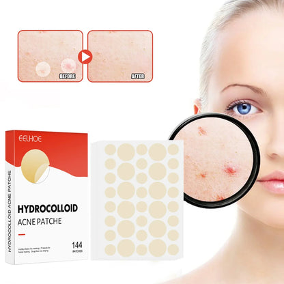 144PCS Acne Pimple Patch Set – Invisible Hydrocolloid Spot Stickers for Face Care & Healing (Men & Women)