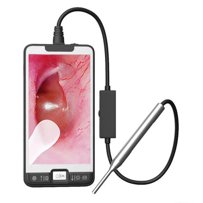 GUANMOU Digital Otoscope – 3.9mm Ear Scope Camera with 6 LED Lights, 4.3" IPS Ear Wax Removal Tool for Kids & Adults