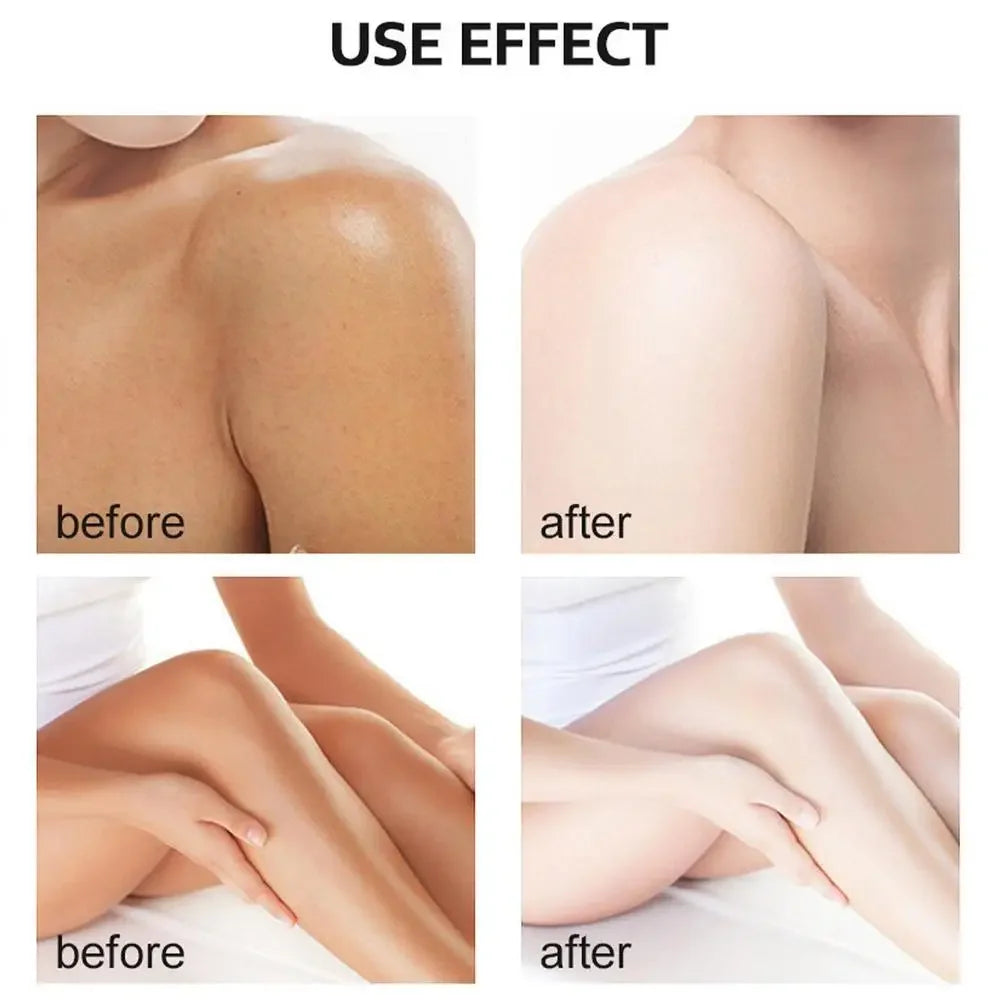 Yellow Peeling Oil – Skin Lightening & Melanin Treatment for Elbows, Knees, Hands, and Even Skin Tone