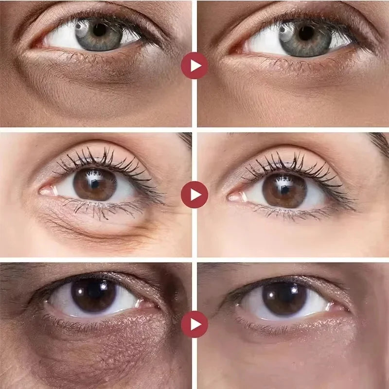 Instant Eye Bag Removal Cream – Collagen, Anti-Wrinkle, Dark Circle & Puffiness Treatment for Firming and Brightening