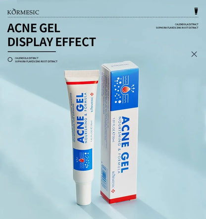Effective Acne Removal Cream 30g – Anti-Acne Gel for Redness, Pimples, Deep Pore Cleaning & Oil Control Skin Care