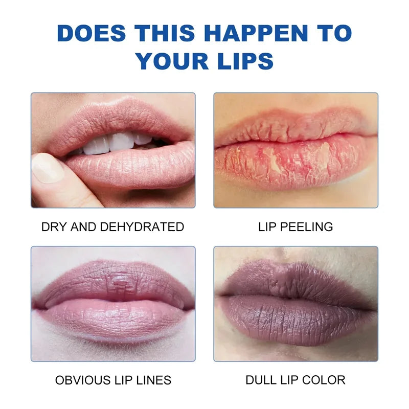 Brightening Melanin-Removing Lipstick – Moisturizing Lip Care with Dead Skin Exfoliation & Nourishing Essence, 8.5g