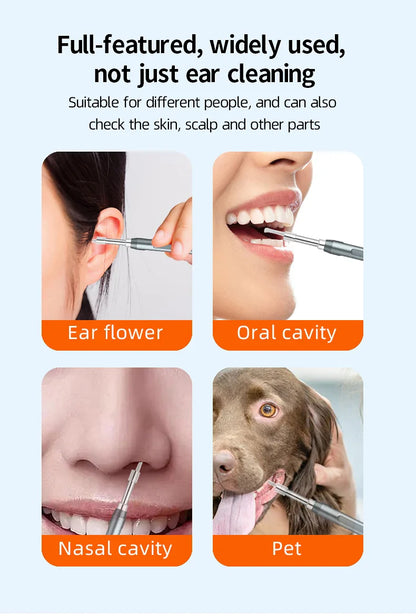 GUANMOU Digital Otoscope – 3.9mm Ear Scope Camera with 6 LED Lights, 4.3" IPS Ear Wax Removal Tool for Kids & Adults