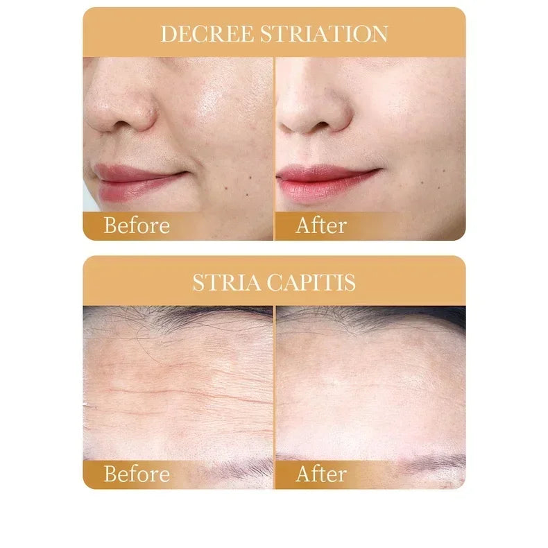 10pcs SADOER Collagen Face Masks – Anti-Wrinkle, Moisturizing & Brightening Skincare