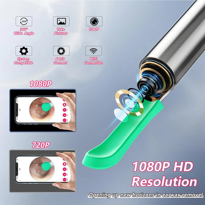 Wireless Ear Cleaner with Camera – USB-C Rechargeable Otoscope Earpick, Wax Removal Endoscope Tool with Mini Camera