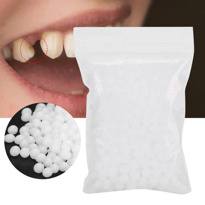 Temporary Tooth Repair Beads – Dental Filling Material for Broken or Missing Teeth
