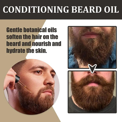 30ml Beard Growth Oil Serum for Men – Nourishing Beard Care Oil to Soften, Strengthen, Style & Promote Healthy Beard Growth
