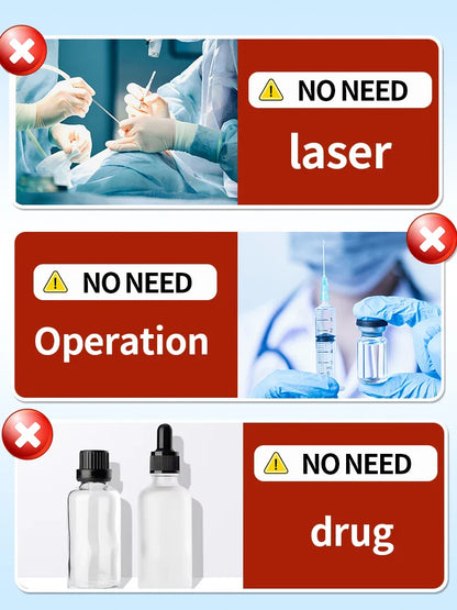 Quick Tattoo Removal Cream – Effective for Pigmented & Permanent Makeup Tattoo Removal
