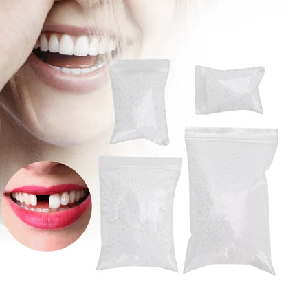 Temporary Tooth Repair Beads – Dental Filling Material for Broken or Missing Teeth