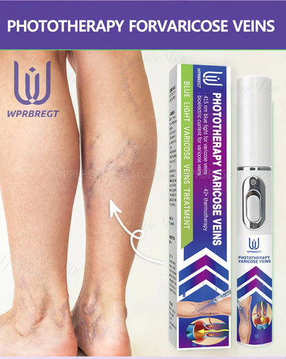 Varicose Vein & Spider Leg Pain Relief Treatment — Painless Care for Vasculitis & Phlebitis