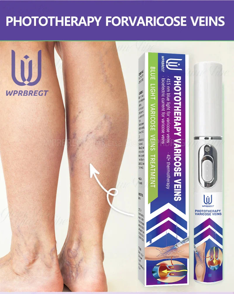 2nd Gen Varicose Vein Laser Therapy Device – Relieves Spider Leg Pain, Treats Vasculitis & Phlebitis