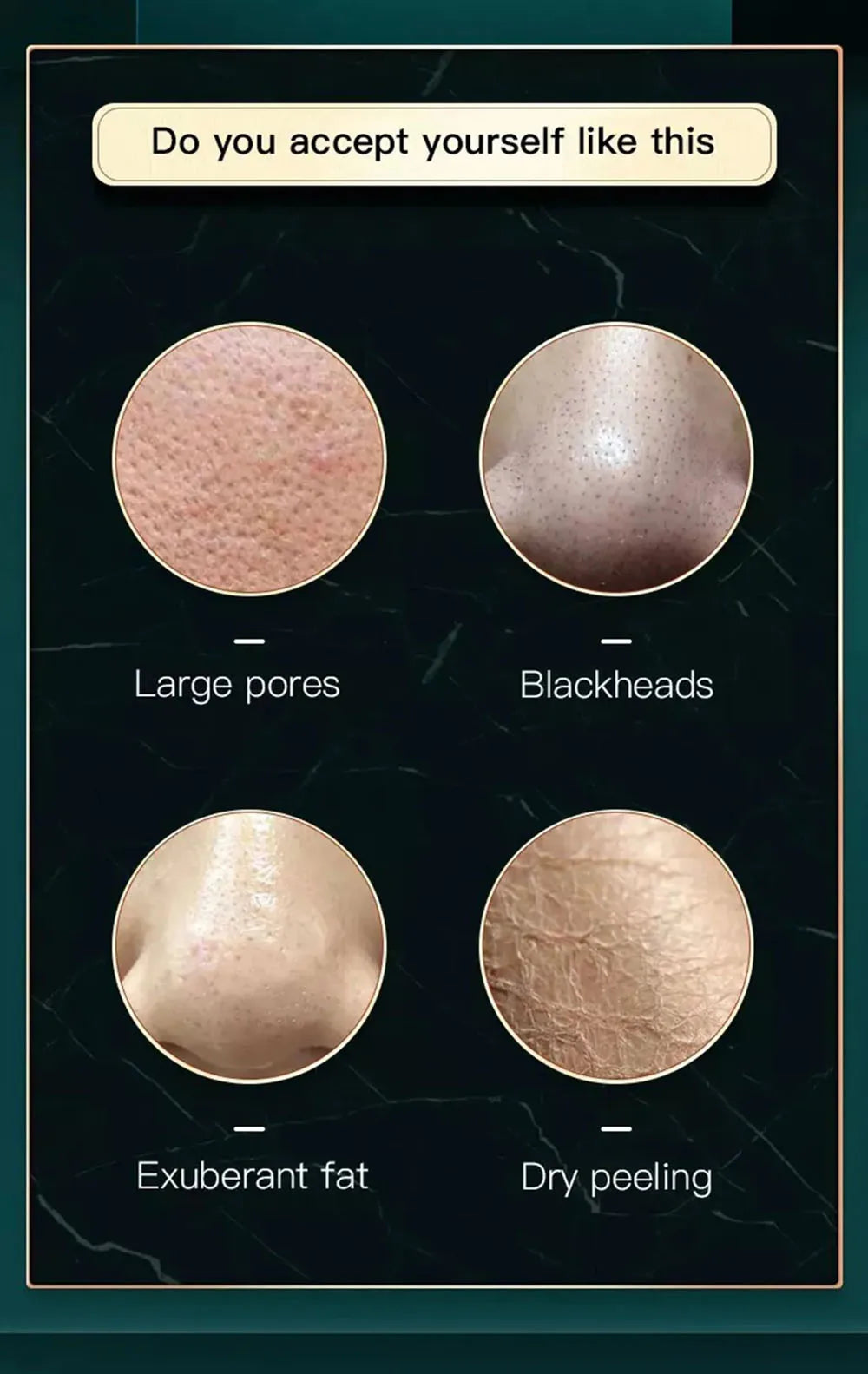 New Peeling Beauty Device – Small Bubble Oxygen Injection Hydra Dermabrasion Aqua Facial Cleaner for Blackhead Removal