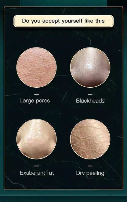 New Peeling Beauty Device – Small Bubble Oxygen Injection Hydra Dermabrasion Aqua Facial Cleaner for Blackhead Removal