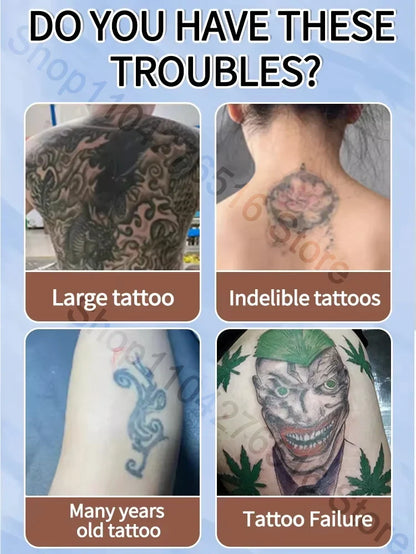 Tattoo Removal Spray — Fast-Acting Formula Removes Tattoos in 7 Days