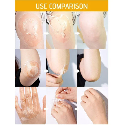Yellow Peeling Lotion – 100% Organic Body Scrub with Hyaluronic Acid, Dark Skin Bleaching, Exfoliating, Whitening & Moisturizing