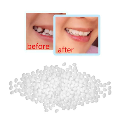 Temporary Tooth Repair Beads – Food Grade Dental Filling Material for Missing or Broken Teeth, False Teeth Glue, Denture Repair