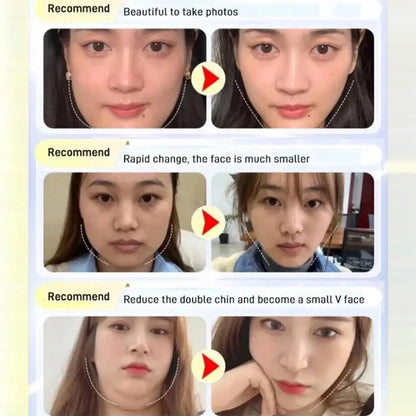Chin & Cheek Slimming V-Shaper Band — Face Lifting Anti-Wrinkle Strap Mask for Beauty & Health