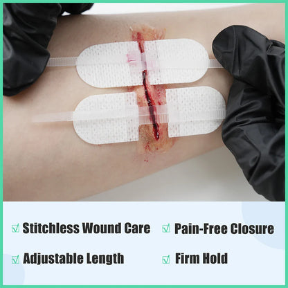 RHINO RESCUE Zip Stitch Wound Closure Kit – Dressings & Strips for Cut Care