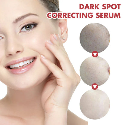 Niacinamide Serum – Dark Spot Correcting, Moisturizing & Brightening, Fades Fine Lines, Deep Cleansing Korean Skincare