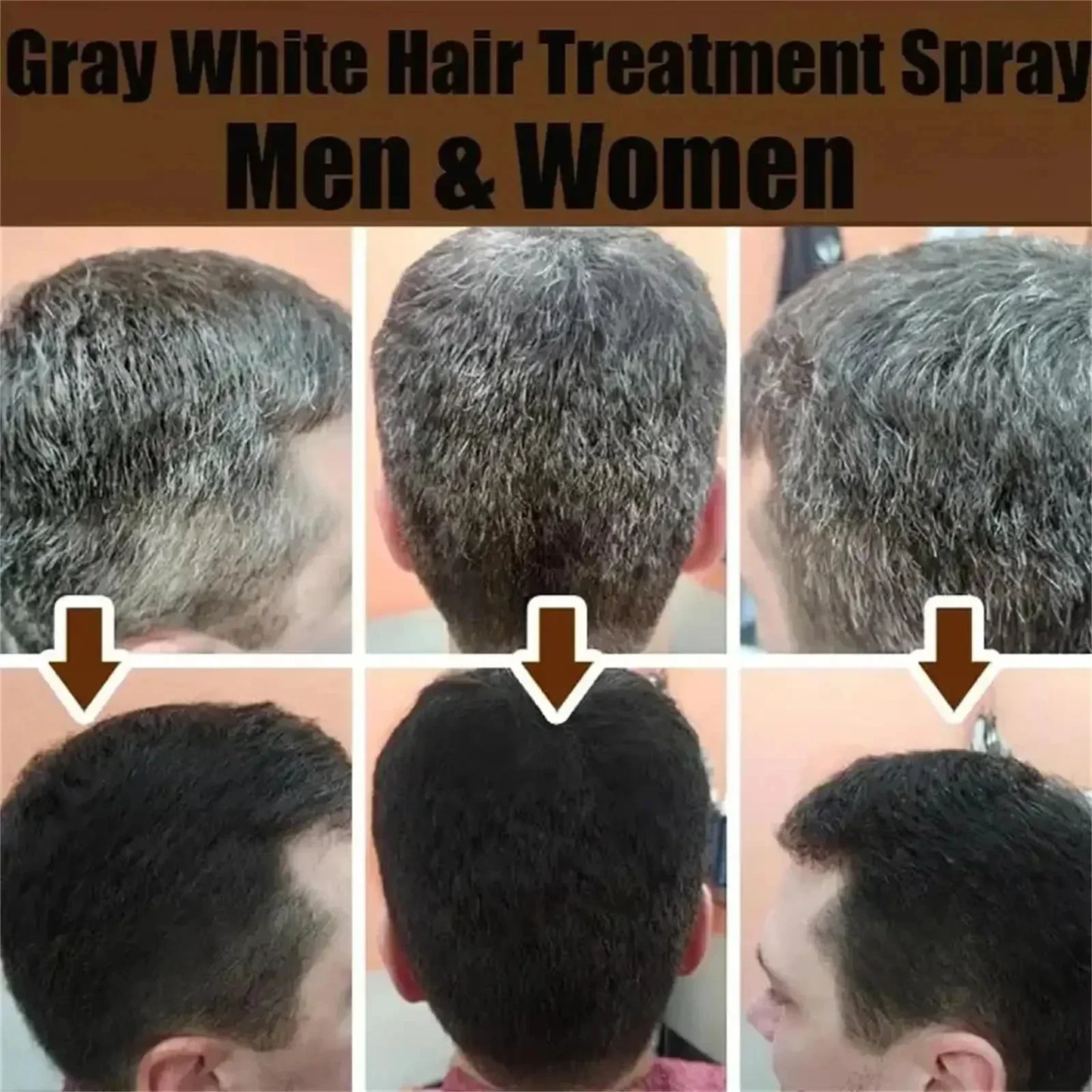 White Hair Remover – Restore Natural Hair Color in 7 Days, Gray Hair Treatment Solution