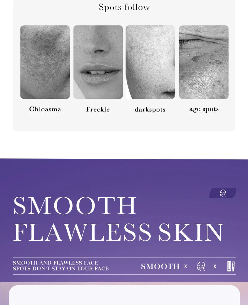 SADOER Freckle Removing Cream — Nicotinamide Moisturizing Face Cream for Hydrating, Nourishing & Firming Skin