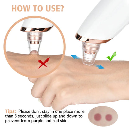 3-Mode Blackhead Remover Vacuum – Facial Pore Cleaner & Dead Skin Removal Beauty Tool