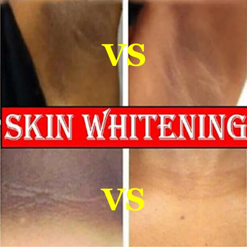 Whitening Cream for Private Parts – Underarm, Inner Thigh & Knee Brightening Serum