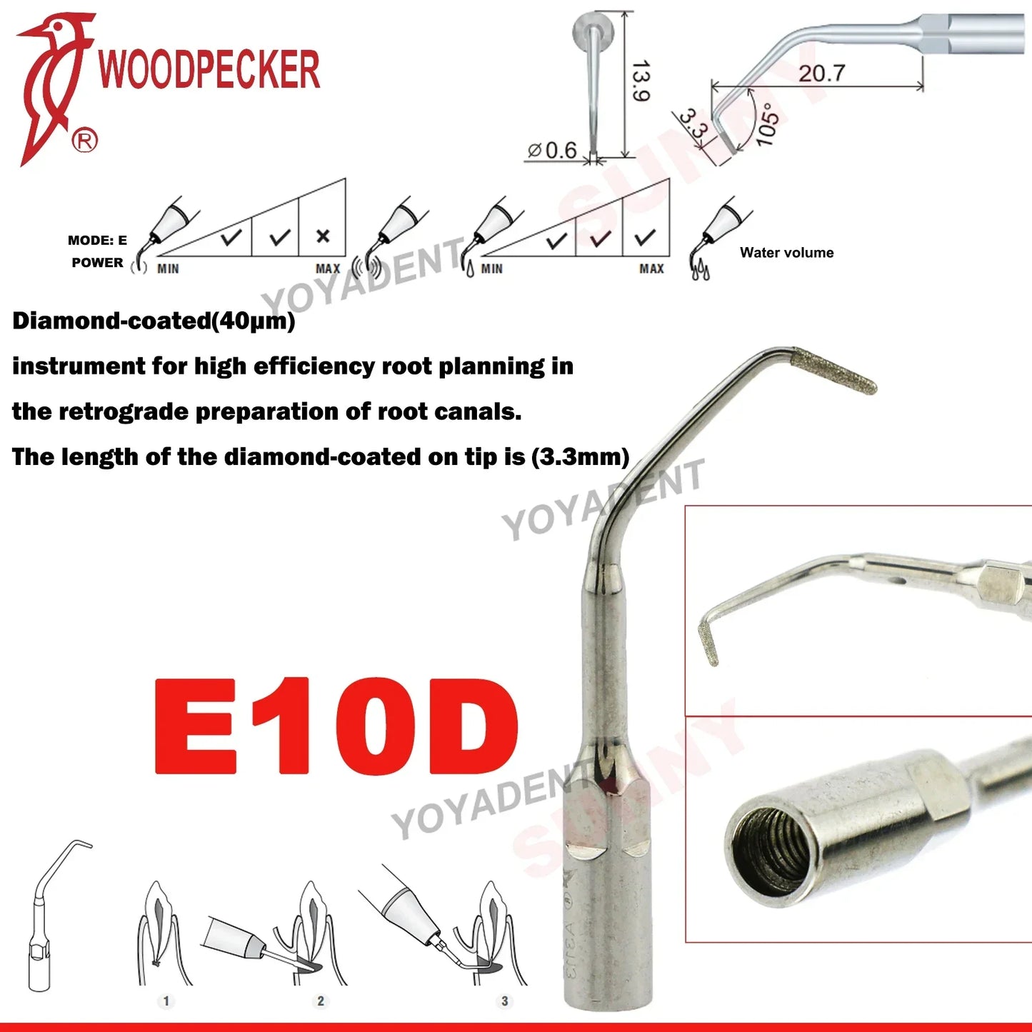 Woodpecker Dental Scaler Tips – Ultrasonic Tooth Cleaning, Endo & Perio Scaling Tips, Fit EMS UDS Scaler Handpiece