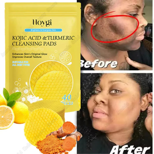 Turmeric & Kojic Acid Facial Cleansing Pads — Lemon Deep Cleanse, Brightening & Whitening Cotton Pads for Face Skincare