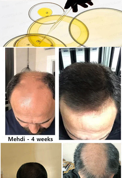 Rapid Hair Growth Serum – Beard, Chest & Body Hair Enhancer for Fuller, Thicker Growth